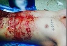 16+/یک حادثه شرم آور در جامعه پزشکی؛ اینستاگرام بازی با بدن بیمار! + عکس