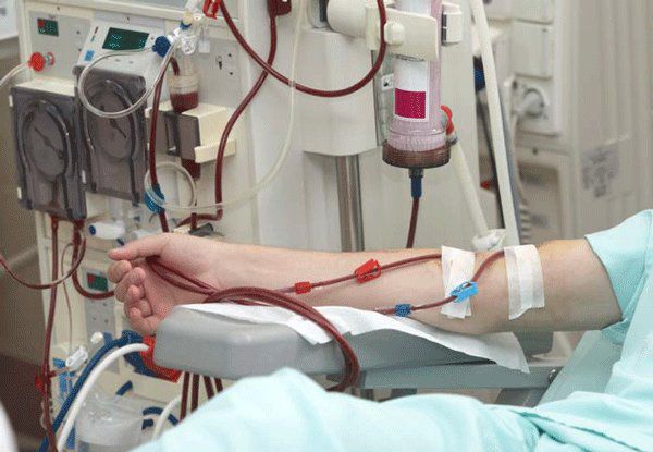 کلینیک دیالیز صفاقی در گرگان راه‌اندازی شد