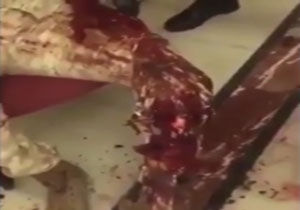 فیلم / صحنه سازی دروغین رسانههای سعودی از زخمی شدن یک سرباز وظیفه در یمن